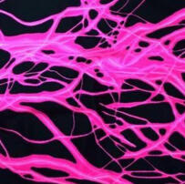 Pink lightning on a black background.